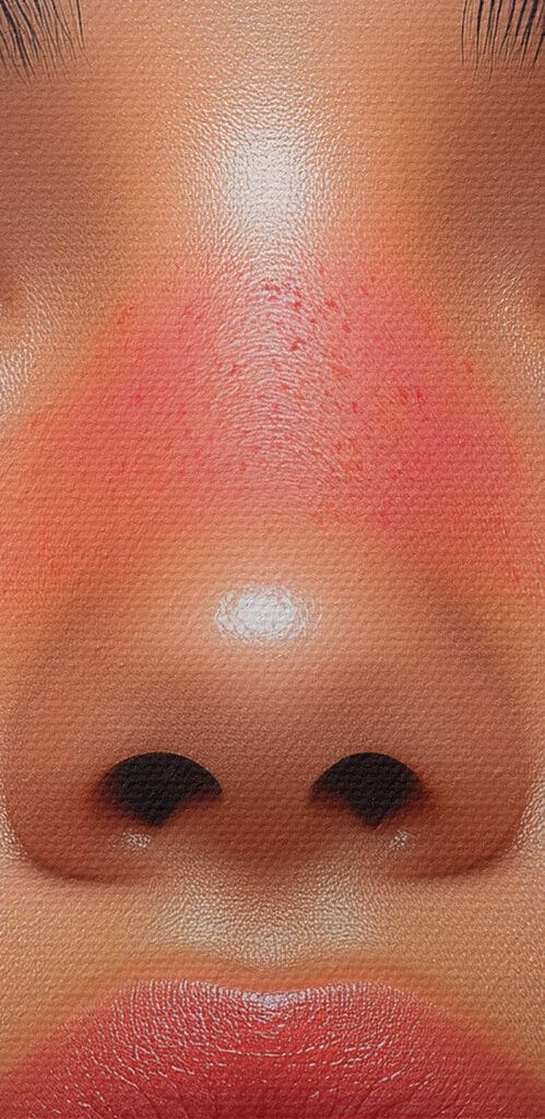 Woman with flowers around her face